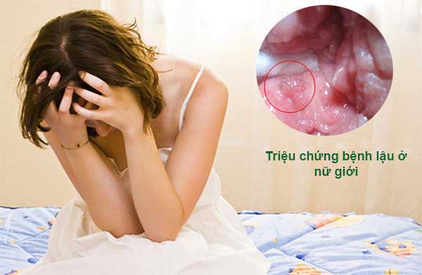 triệu chứng bệnh lậu ở nữ giới dễ bị nhầm lẫn với các bệnh phụ khoa thông thường 