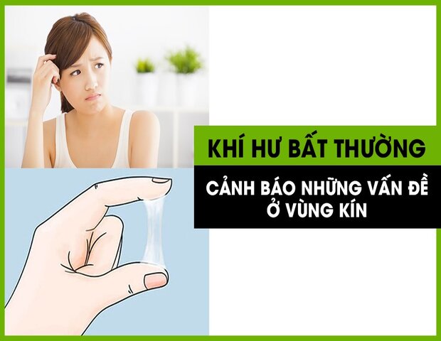 cần điều trị khí hư bất thường vì rất có thể chị em đang mắc bệnh lý phụ khoa