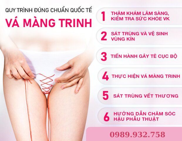quy trình tiến hành thủ thuật vá màng trinh quy trình tiến hành thủ thuật vá màng trinh