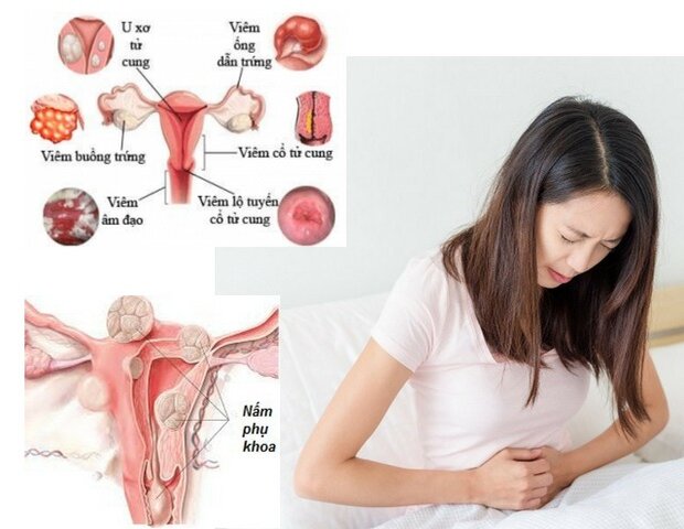 một số căn bệnh phụ khoa chị em thường hay mắc phải