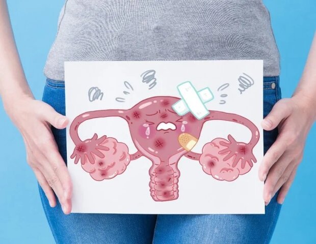 chị em cần tìm cách trị kinh nguyệt không đều sớm nếu liên quan đến bệnh phụ khoa
