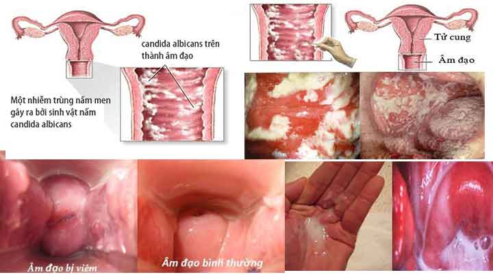 khám viêm âm đạo ở đâu Quảng Ngãi